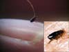Picture of Flea size on finger